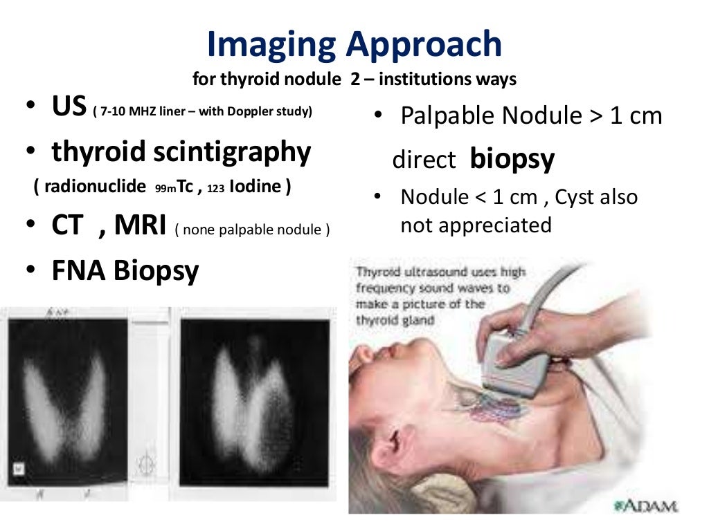 Thyroid lesions evaluation with sonography