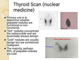 Thyroid Ultra
Thyroid Ultra






Sonography
Sonography
Painless, quick, no
Painless, quick, no
contrast material, n...