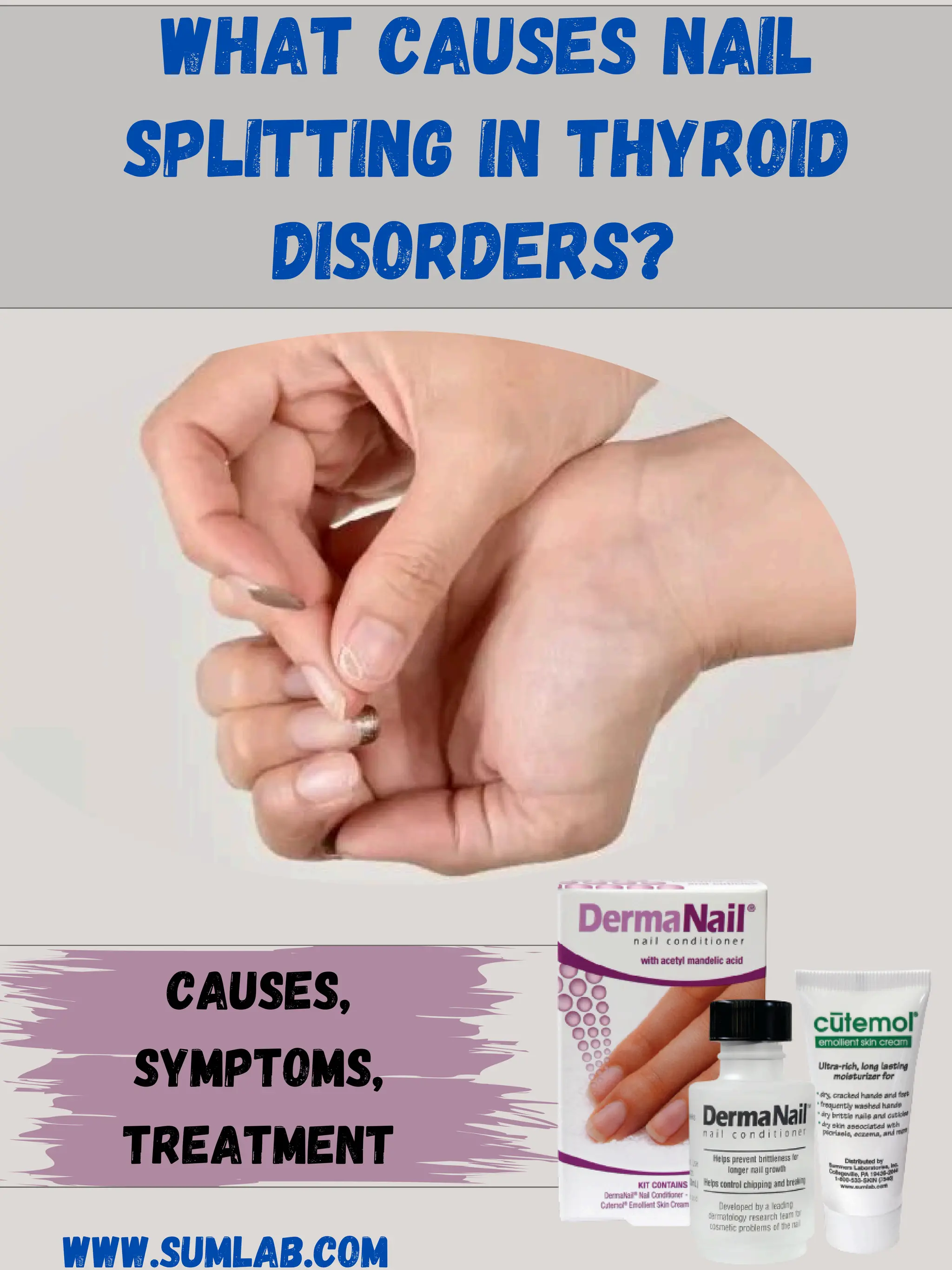 What Causes Nail Splitting in Thyroid Disorders? PDF
