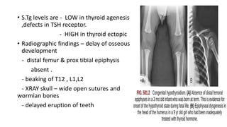• S.Tg levels are - LOW in thyroid agenesis
,defects in TSH receptor.
- HIGH in thyroid ectopic
• Radiographic findings – delay of osseous
development
- distal femur & prox tibial epiphysis
absent .
- beaking of T12 , L1,L2
- XRAY skull – wide open sutures and
wormian bones
- delayed eruption of teeth
 