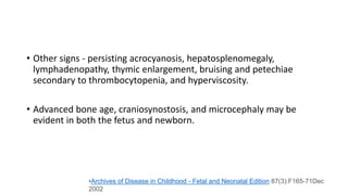 • Other signs - persisting acrocyanosis, hepatosplenomegaly,
lymphadenopathy, thymic enlargement, bruising and petechiae
secondary to thrombocytopenia, and hyperviscosity.
• Advanced bone age, craniosynostosis, and microcephaly may be
evident in both the fetus and newborn.
•Archives of Disease in Childhood - Fetal and Neonatal Edition 87(3):F165-71Dec
2002
 