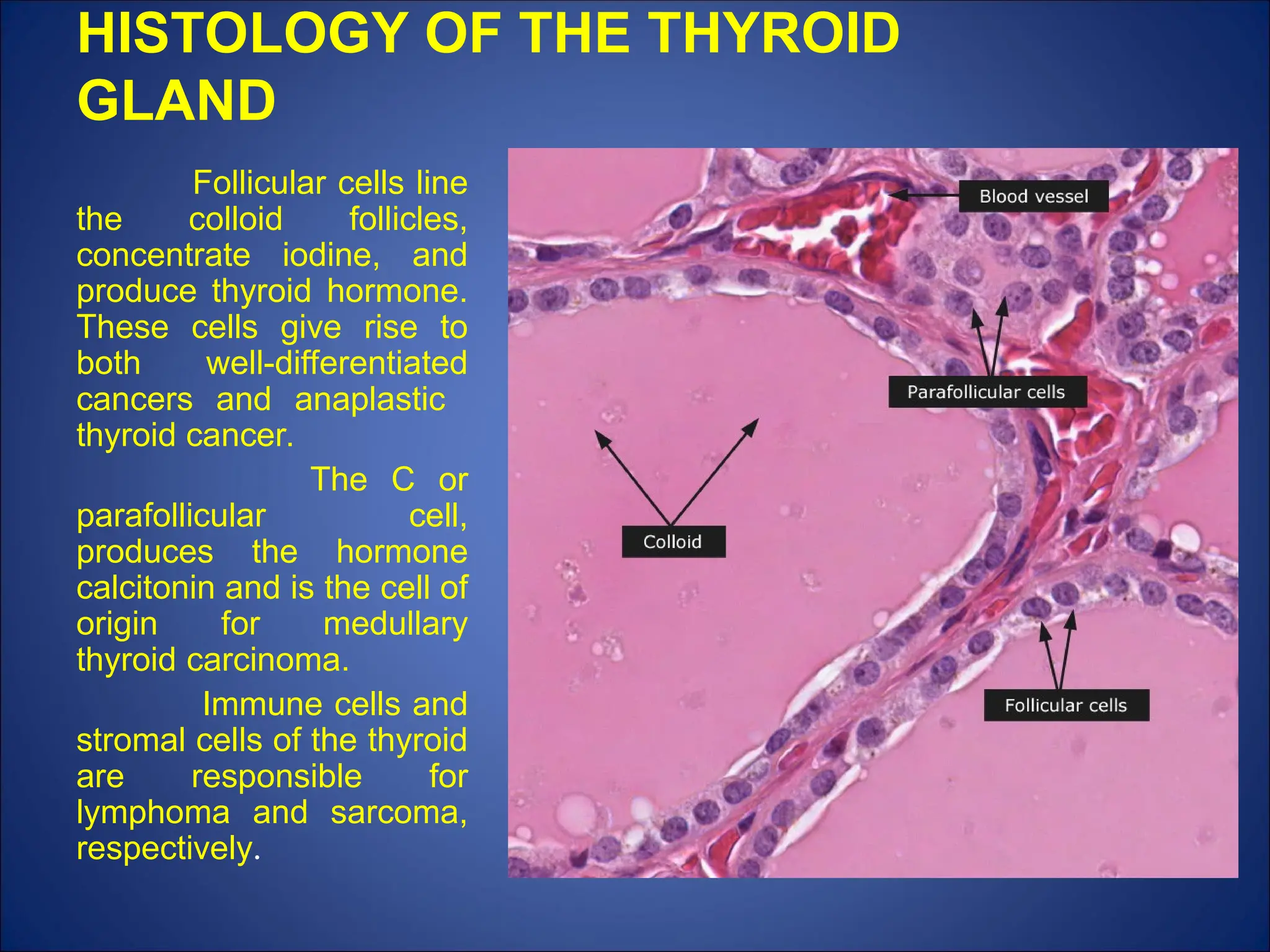 HISTOLOGY OF THE THYROID
GLAND
Follicular cells line
the colloid follicles,
concentrate iodine, and
produce thyroid hormone.
These cells give rise to
both well-differentiated
cancers and anaplastic
thyroid cancer.
The C or
parafollicular cell,
produces the hormone
calcitonin and is the cell of
origin for medullary
thyroid carcinoma.
Immune cells and
stromal cells of the thyroid
are responsible for
lymphoma and sarcoma,
respectively.
 