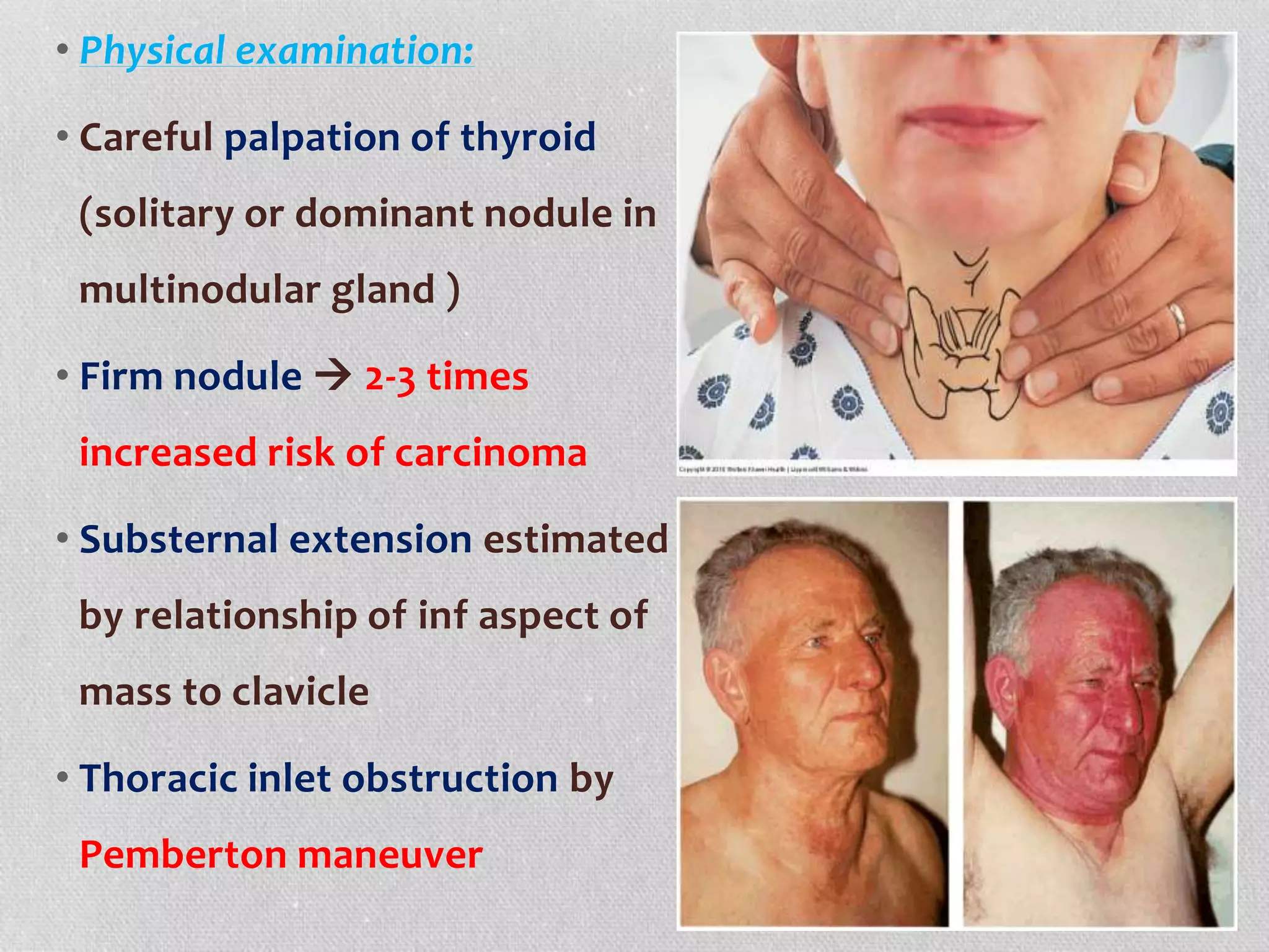 • Physical examination:
• Careful palpation of thyroid
(solitary or dominant nodule in
multinodular gland )
• Firm nodule  2-3 times
increased risk of carcinoma
• Substernal extension estimated
by relationship of inf aspect of
mass to clavicle
• Thoracic inlet obstruction by
Pemberton maneuver
 