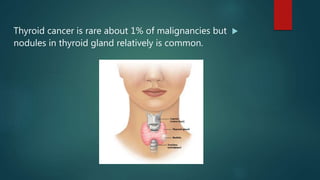 Thyroid cancer is rare about 1% of malignancies but
nodules in thyroid gland relatively is common.
 