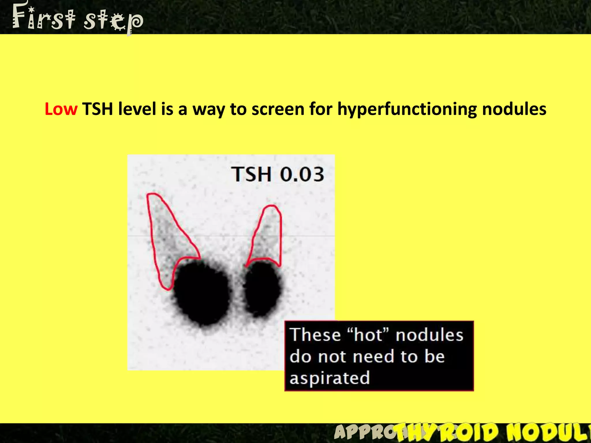 Approach to Thyroid nodules | PPTX