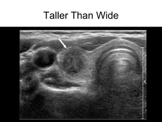 Taller Than Wide
 