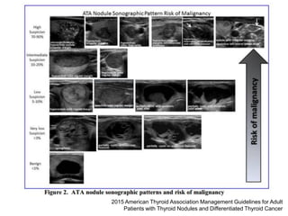 2015 American Thyroid Association Management Guidelines for Adult
Patients with Thyroid Nodules and Differentiated Thyroid Cancer
 