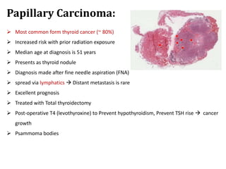 Papillary Carcinoma:
 Most common form thyroid cancer (~ 80%)
 Increased risk with prior radiation exposure
 Median age at diagnosis is 51 years
 Presents as thyroid nodule
 Diagnosis made after fine needle aspiration (FNA)
 spread via lymphatics  Distant metastasis is rare
 Excellent prognosis
 Treated with Total thyroidectomy
 Post-operative T4 (levothyroxine) to Prevent hypothyroidism, Prevent TSH rise  cancer
growth
 Psammoma bodies
 