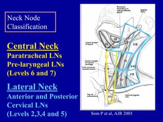 Neck Node
Classification

Central Neck
Paratracheal LNs
Pre-laryngeal LNs
(Levels 6 and 7)
Lateral Neck
Anterior and Poste...