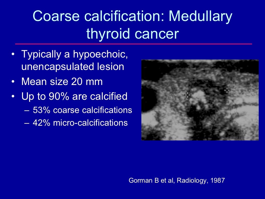 The Epidemic of Thyroid Nodules Which Should Undergo Fine Needle Asp…