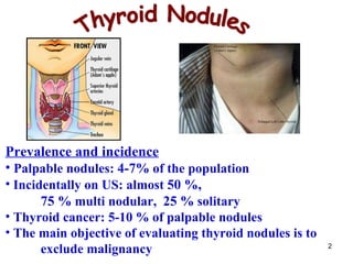 Thyroid Nodules Prevalence and incidence Palpable nodules:  4-7 %  of the population Incidentally on US: almost  50  %,   75  %  multi nodular,  25  %  solitary  Thyroid cancer:  5-10  % of palpable nodules The main objective of evaluating thyroid nodules is to  exclude malignancy  