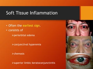 Soft Tissue Inflammation
• Often the earliest sign.
• consists of
periorbital edema
conjunctival hyperemia
chemosis
superior limbic keratoconjunctivitis
 