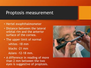 Proptosis measurement
• Hertel exophthalmometer
• Distance between the lateral
orbital rim and the anterior
surface of the cornea.
• The upper limit of normal
whites -18 mm
blacks -21 mm
Asians -12-18 mm.
• A difference in reading of more
than 2 mm between the two
eyes is suggestive of proptosis.
 
