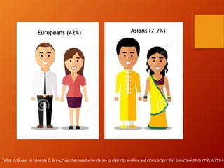 Asians (7.7%)Europeans (42%)
Tellez M, Cooper J, Edmonds C. Graves’ ophthalmopathy in relation to cigarette smoking and ethnic origin. Clin Endocrinol (Oxf) 1992;36:291-4.
 
