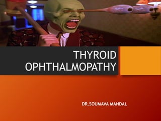 THYROID
OPHTHALMOPATHY
DR.SOUMAVA MANDAL
 
