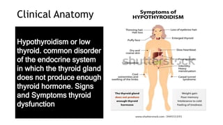 Clinical Anatomy
Hypothyroidism or low
thyroid. common disorder
of the endocrine system
in which the thyroid gland
does not produce enough
thyroid hormone. Signs
and Symptoms thyroid
dysfunction
 