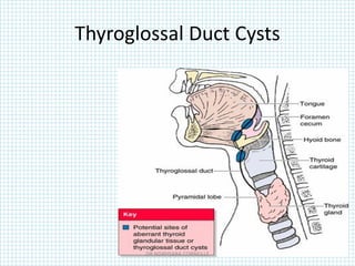 Thyroglossal Duct Cysts
DR NDAYISABA CORNEILLE
 