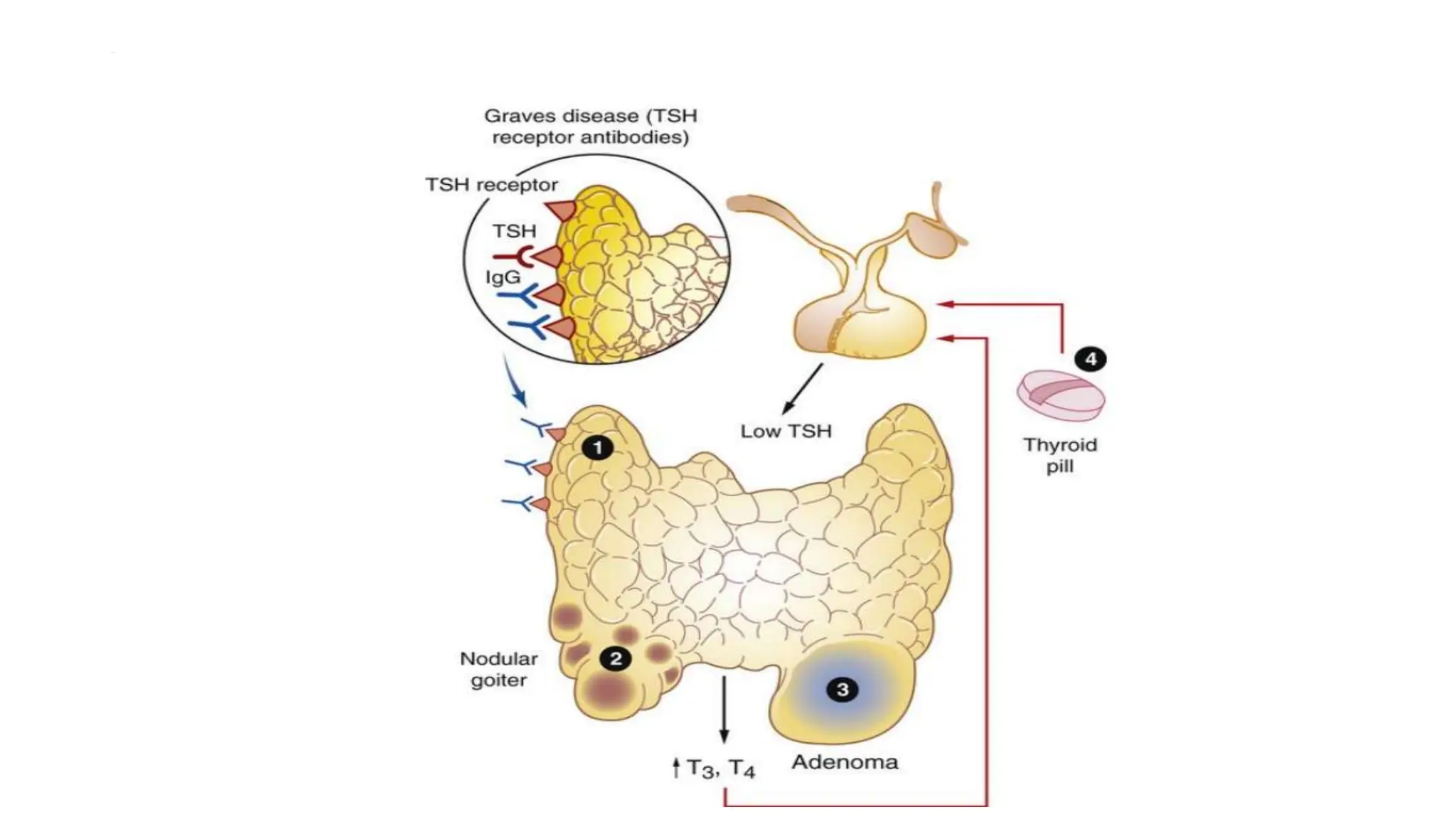 THYROID PATHOLOGY detailing the management, definitions and treatment ...