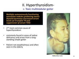 Thyroid pathophysiology scintigraphy[1] | PPTX