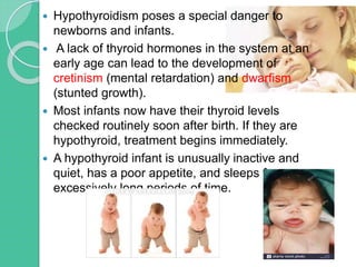  Hypothyroidism poses a special danger to
newborns and infants.
 A lack of thyroid hormones in the system at an
early age can lead to the development of
cretinism (mental retardation) and dwarfism
(stunted growth).
 Most infants now have their thyroid levels
checked routinely soon after birth. If they are
hypothyroid, treatment begins immediately.
 A hypothyroid infant is unusually inactive and
quiet, has a poor appetite, and sleeps for
excessively long periods of time.
 