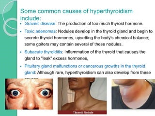  Graves' disease: The production of too much thyroid hormone.
 Toxic adenomas: Nodules develop in the thyroid gland and begin to
secrete thyroid hormones, upsetting the body's chemical balance;
some goiters may contain several of these nodules.
 Subacute thyroiditis: Inflammation of the thyroid that causes the
gland to "leak" excess hormones,
 Pituitary gland malfunctions or cancerous growths in the thyroid
gland: Although rare, hyperthyroidism can also develop from these
causes.
Some common causes of hyperthyroidism
include:
 