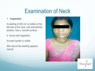Examination of Neck
 Inspection:
A swelling of 4X3 cm is visible on the
left side of the neck, with well defined
borders. Has a smooth surface.
It moves with deglutition
Its lower border is visible
Skin above the swelling appears
normal
 