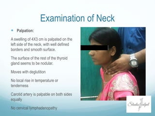 Examination of Neck
 Palpation:
A swelling of 4X3 cm is palpated on the
left side of the neck, with well defined
borders and smooth surface.
The surface of the rest of the thyroid
gland seems to be nodular.
Moves with deglutition
No local rise in temperature or
tenderness
Carotid artery is palpable on both sides
equally
No cervical lymphadenopathy
 