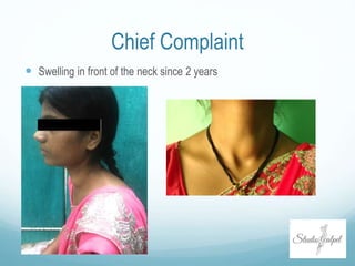 Chief Complaint
 Swelling in front of the neck since 2 years
 