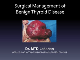 Surgical Management of
Benign Thyroid Disease

Dr. MTD Lakshan
MBBS (Col) MS (OTO) DOHNS FEB ORL-HNS FRCSEd ORL-HNS

 