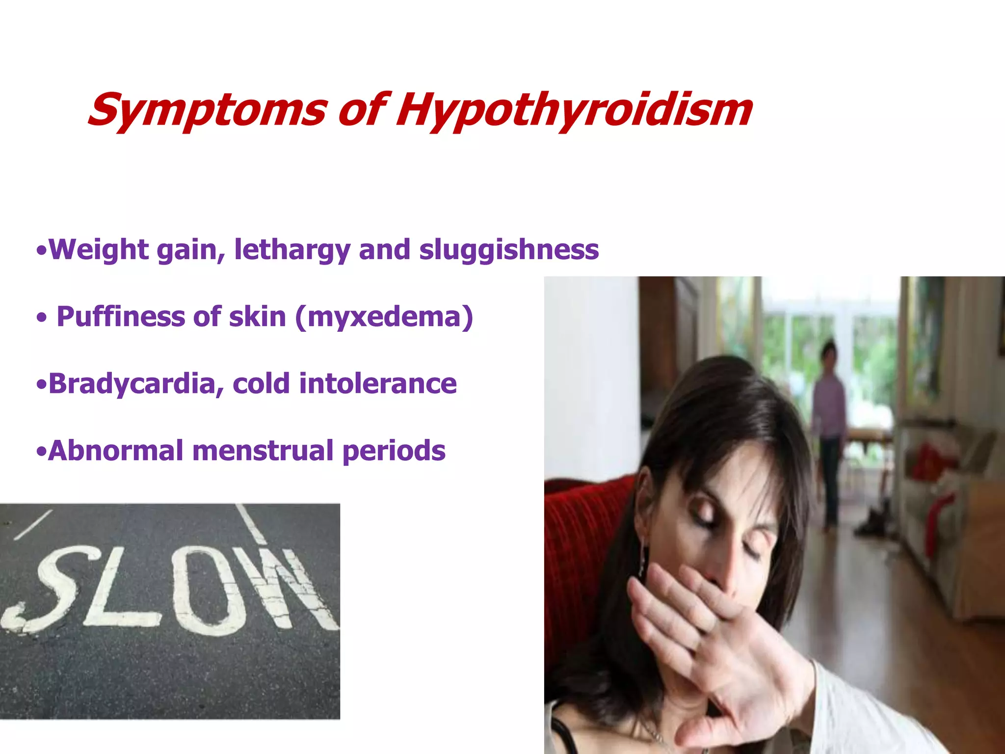 •Weight gain, lethargy and sluggishness
• Puffiness of skin (myxedema)
•Bradycardia, cold intolerance
•Abnormal menstrual periods
Symptoms of Hypothyroidism
 
