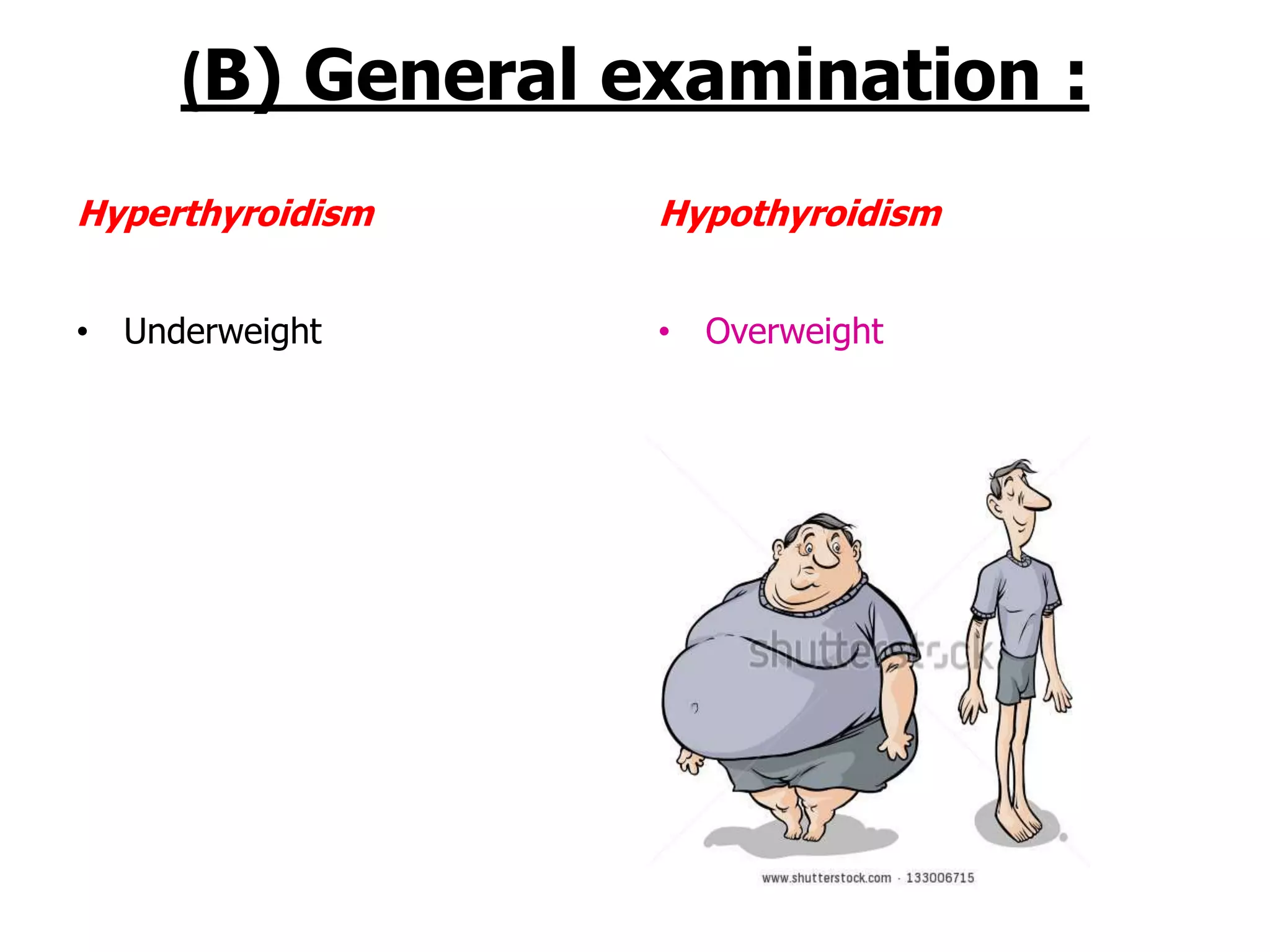 (B) General examination :
• Underweight • Overweight
Hyperthyroidism Hypothyroidism
 