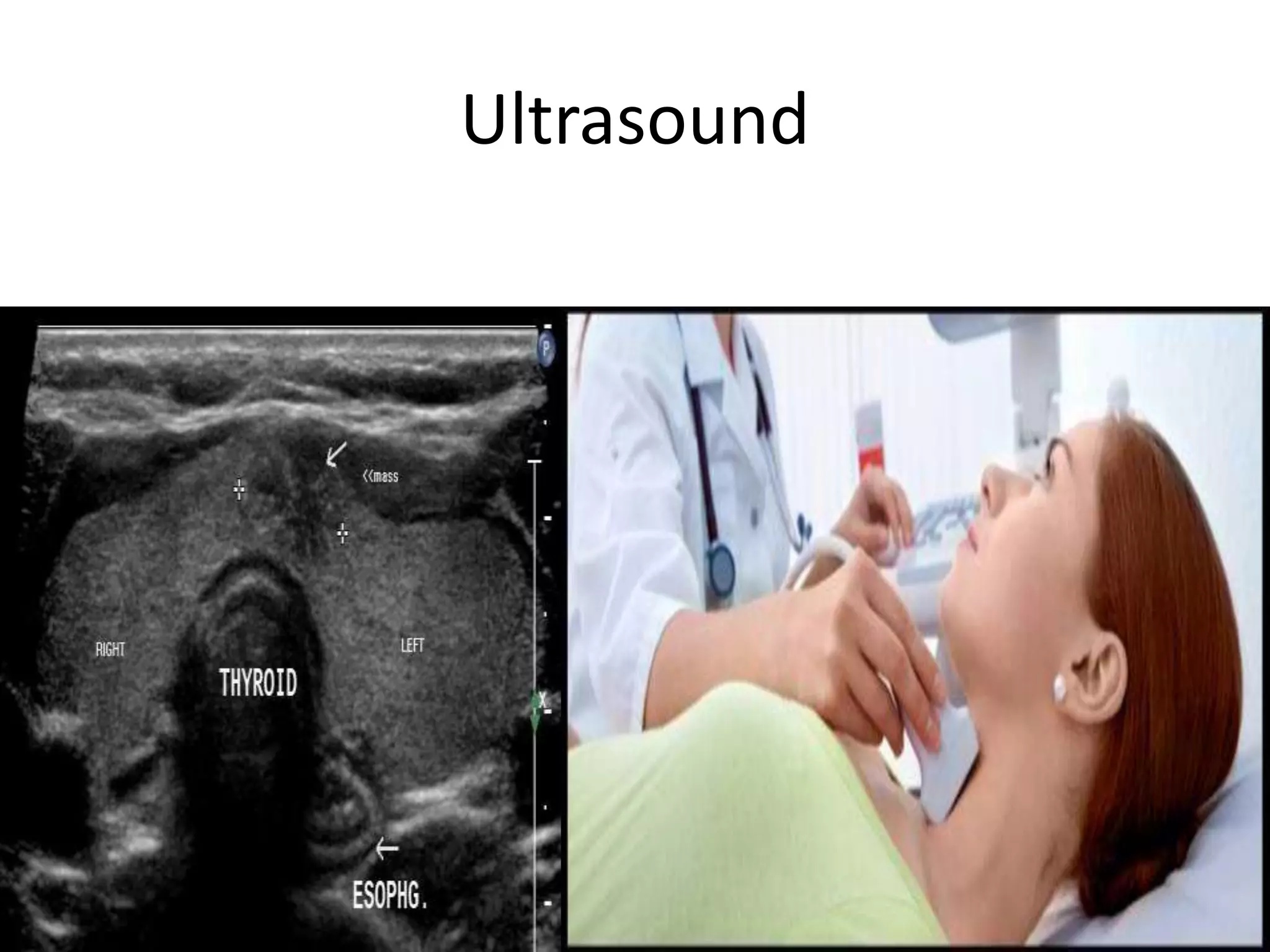 Ultrasound
 