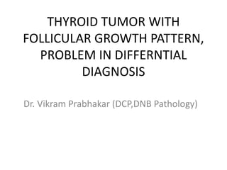 THYROID TUMOR WITH
FOLLICULAR GROWTH PATTERN,
PROBLEM IN DIFFERNTIAL
DIAGNOSIS
Dr. Vikram Prabhakar (DCP,DNB Pathology)
 