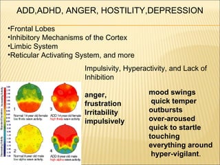 ADD,ADHD, ANGER, HOSTILITY,DEPRESSION
•Frontal Lobes
•Inhibitory Mechanisms of the Cortex
•Limbic System
•Reticular Activating System, and more
Impulsivity, Hyperactivity, and Lack of
Inhibition
anger,
frustration
Irritability
impulsively
mood swings
quick temper
outbursts
over-aroused
quick to startle
touching
everything around
hyper-vigilant.
 