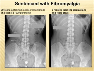 Thyroid stress and inflammation