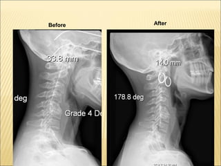 Thyroid stress and inflammation