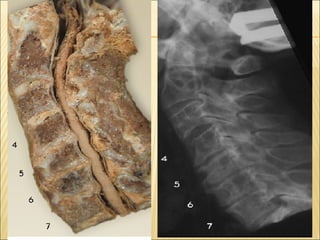 Thyroid stress and inflammation