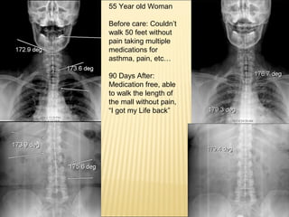 Thyroid stress and inflammation