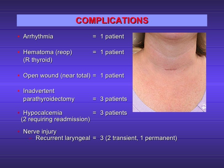 Thyroid Surgery by Miniincision