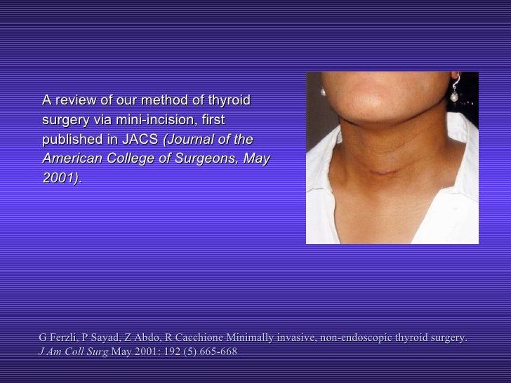 Thyroid Surgery by Miniincision