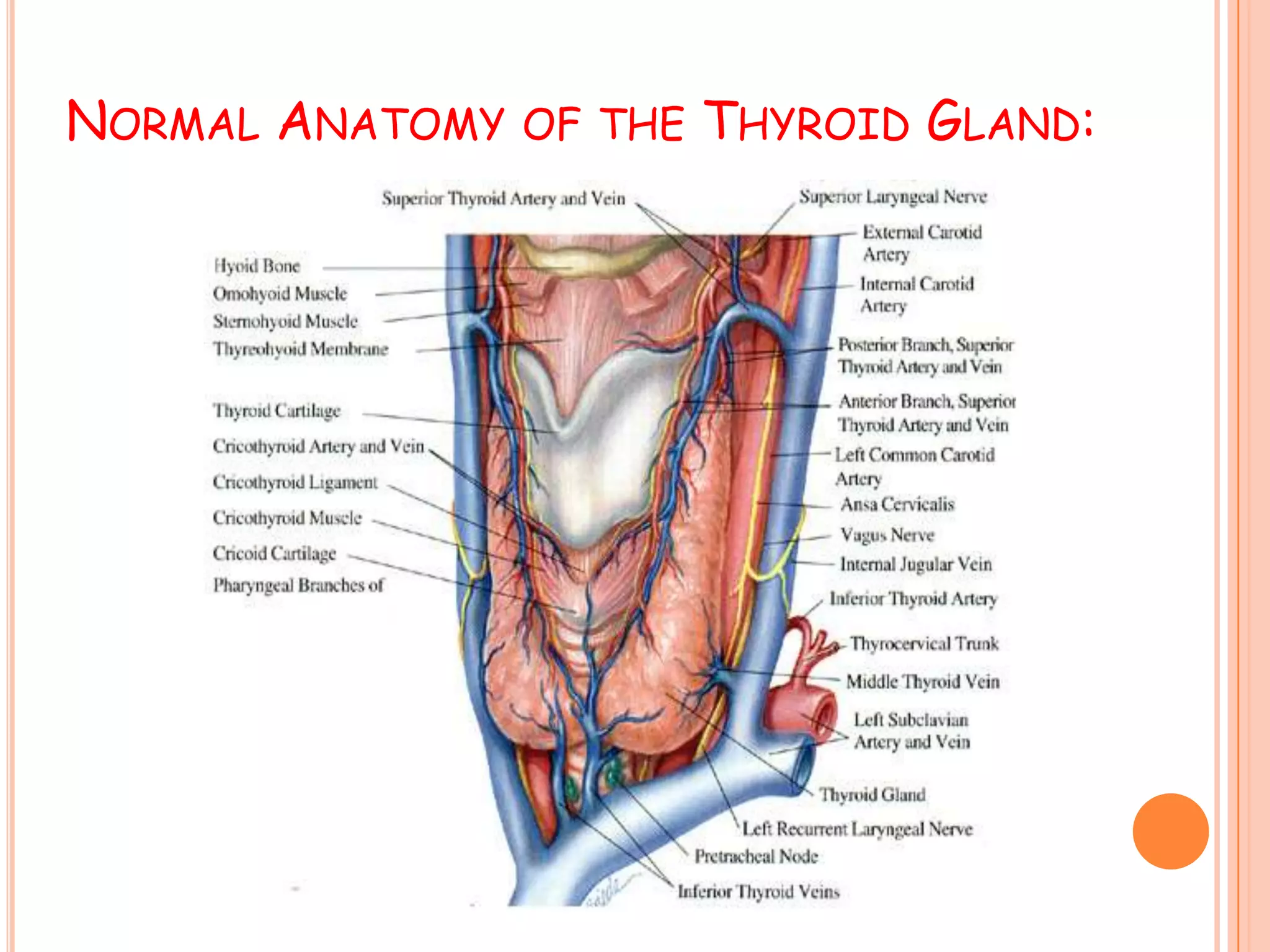 Thyroid Tumor