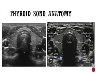 THYROID SONO ANATOMY
 