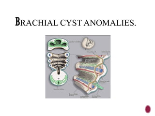 BRACHIAL CYST ANOMALIES.
 