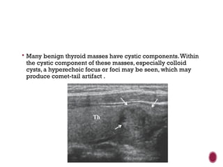  Many benign thyroid masses have cystic components.Within
the cystic component of these masses, especially colloid
cysts, a hyperechoic focus or foci may be seen, which may
produce comet-tail artifact .
 