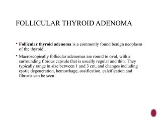 FOLLICULAR THYROID ADENOMA
 Follicular thyroid adenoma is a commonly found benign neoplasm
of the thyroid .
 Macroscopically follicular adenomas are round to oval, with a
surrounding fibrous capsule that is usually regular and thin. They
typically range in size between 1 and 3 cm, and changes including
cystic degeneration, hemorrhage, ossification, calcification and
fibrosis can be seen
 