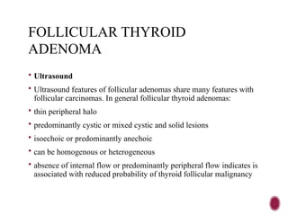 FOLLICULAR THYROID
ADENOMA
 Ultrasound
 Ultrasound features of follicular adenomas share many features with
follicular carcinomas. In general follicular thyroid adenomas:
 thin peripheral halo
 predominantly cystic or mixed cystic and solid lesions
 isoechoic or predominantly anechoic
 can be homogenous or heterogeneous
 absence of internal flow or predominantly peripheral flow indicates is
associated with reduced probability of thyroid follicular malignancy
 