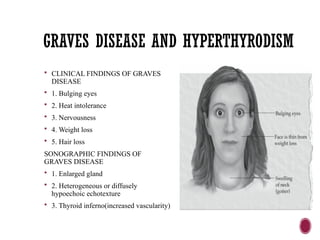 GRAVES DISEASE AND HYPERTHYRODISM
 CLINICAL FINDINGS OF GRAVES
DISEASE
 1. Bulging eyes
 2. Heat intolerance
 3. Nervousness
 4. Weight loss
 5. Hair loss
SONOGRAPHIC FINDINGS OF
GRAVES DISEASE
 1. Enlarged gland
 2. Heterogeneous or diffusely
hypoechoic echotexture
 3. Thyroid inferno(increased vascularity)
 