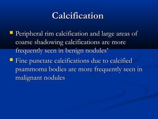Peripheral Calcification thyroid ultrasound, from basic imaging point of view | PDF