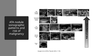 Clinical Application of Thyroid Ultrasound in the Diagnosis of Thyroid ...