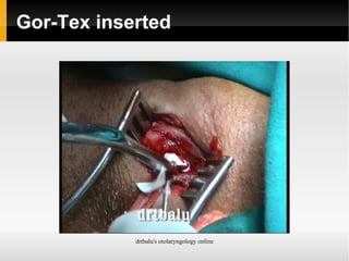 Contraindications Previous history of irradiation 